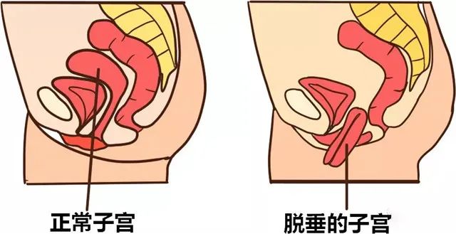 盆腔器(qì)官